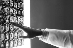 brain cancer research